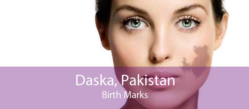Daska, Pakistan Birth Marks
