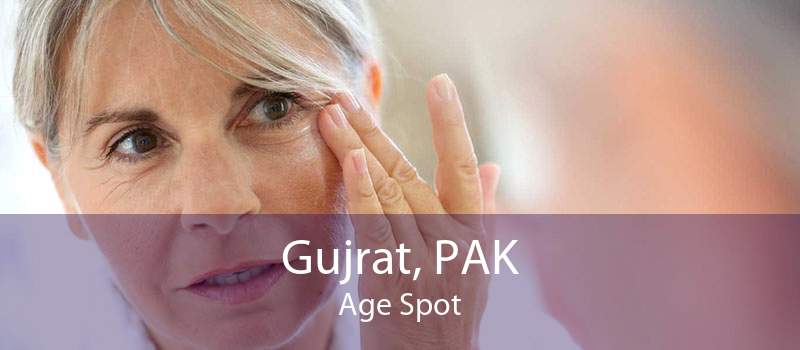 Gujrat, PAK Age Spot