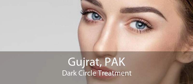 Gujrat, PAK Dark Circle Treatment