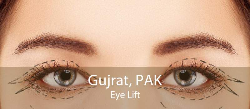 Gujrat, PAK Eye Lift