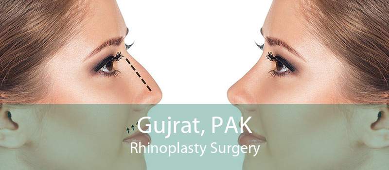 Gujrat, PAK Rhinoplasty Surgery