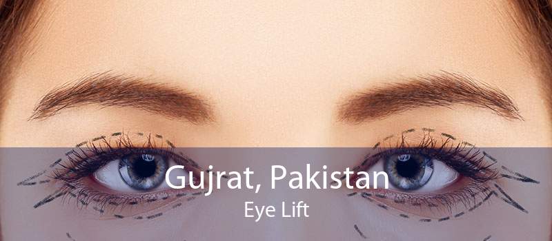 Gujrat, Pakistan Eye Lift