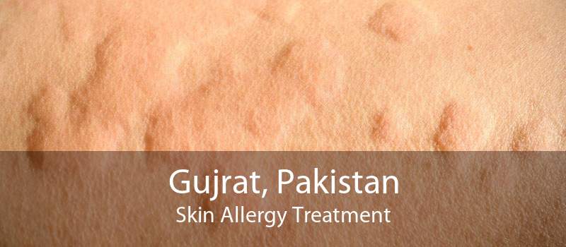 Gujrat, Pakistan Skin Allergy Treatment