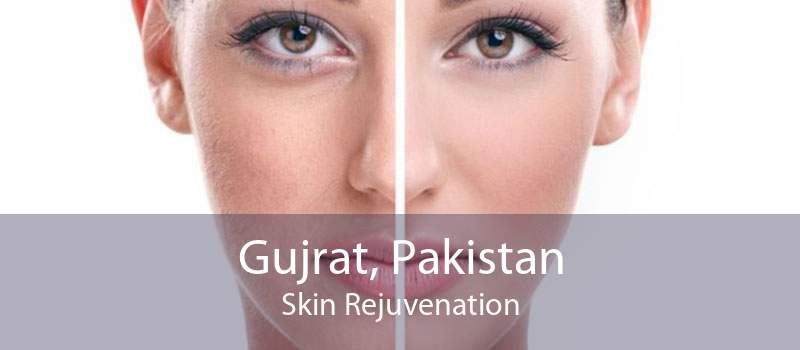 Gujrat, Pakistan Skin Rejuvenation