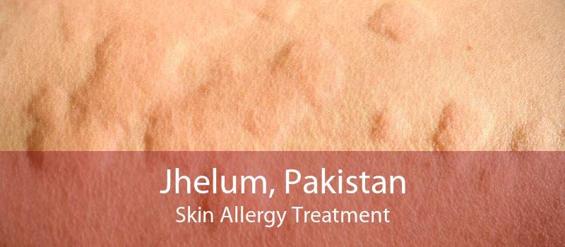 Jhelum, Pakistan Skin Allergy Treatment