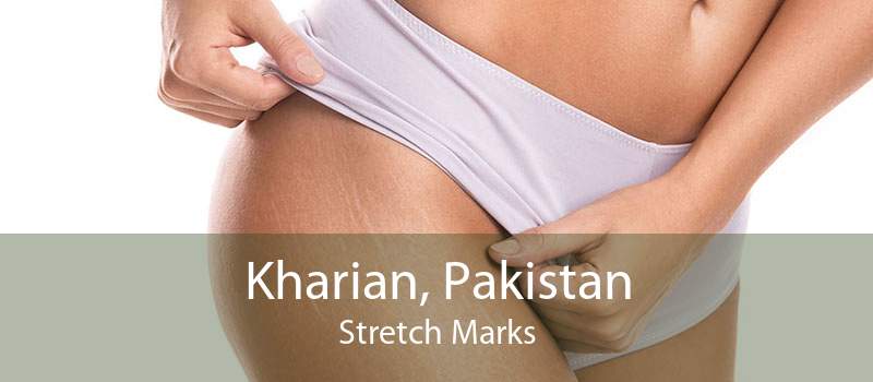 Kharian, Pakistan Stretch Marks