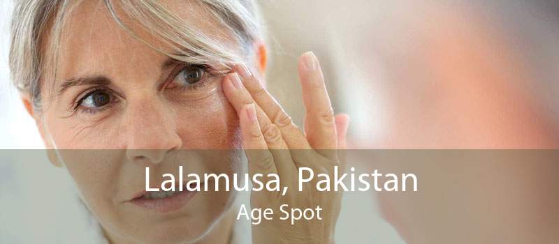 Lalamusa, Pakistan Age Spot