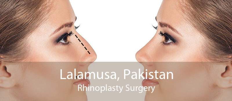 Lalamusa, Pakistan Rhinoplasty Surgery