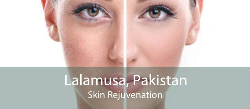 Lalamusa, Pakistan Skin Rejuvenation