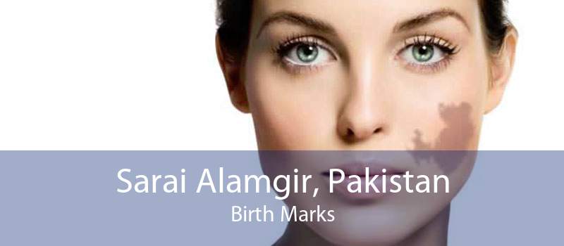 Sarai Alamgir, Pakistan Birth Marks