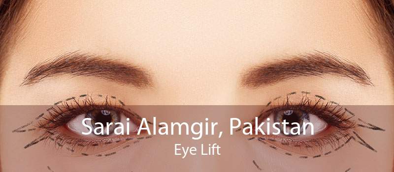 Sarai Alamgir, Pakistan Eye Lift