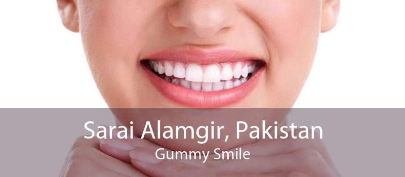 Sarai Alamgir, Pakistan Gummy Smile