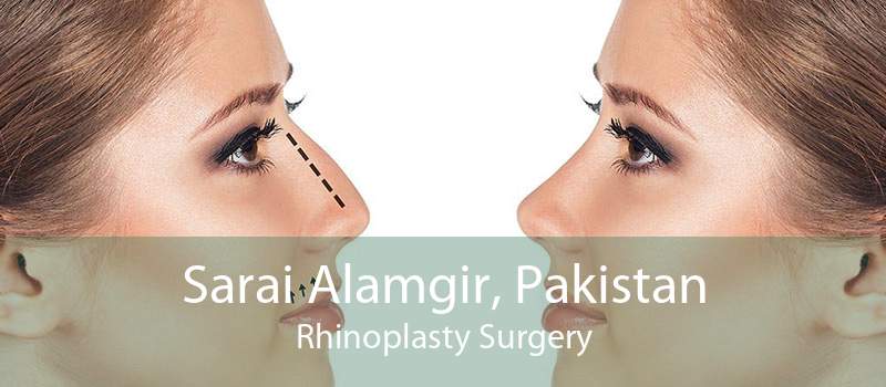 Sarai Alamgir, Pakistan Rhinoplasty Surgery