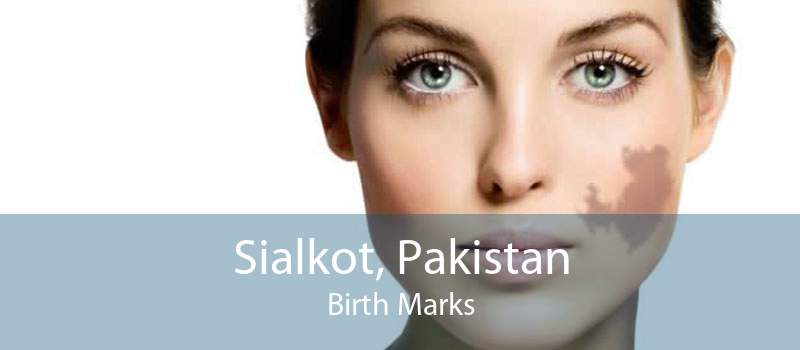 Sialkot, Pakistan Birth Marks