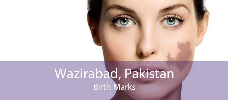 Wazirabad, Pakistan Birth Marks