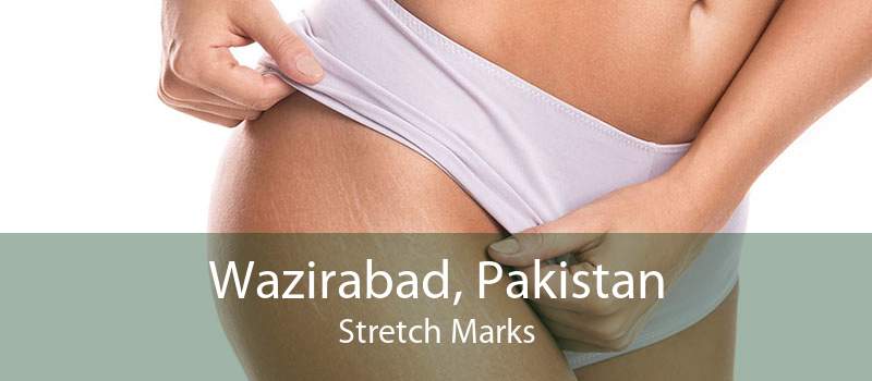 Wazirabad, Pakistan Stretch Marks